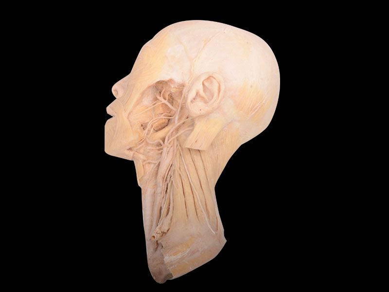Plastinated deep vascular and nerves of head and neck