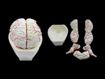 Model of brain and brain artery