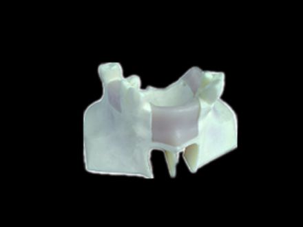 Dental implant operation model including Maxilla and mandible