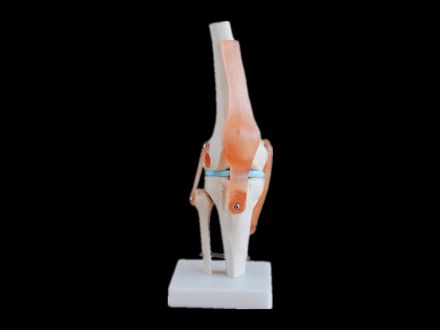 Knee joint with ligament