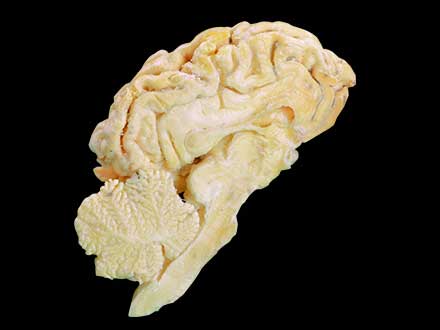 Brain hemisphere of sheep plastinated specimen