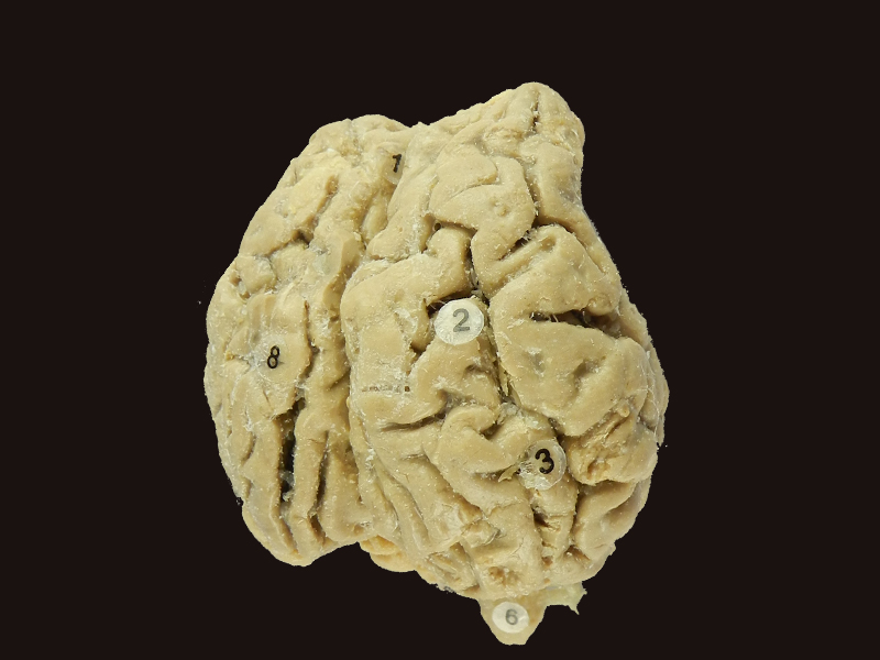 Brain of Horse specimen for sale