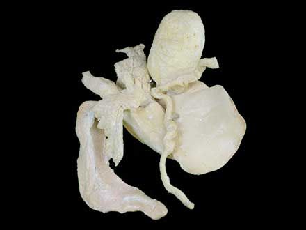 Cattle liver biliary pancreas spleen duodenum plastinated specimen