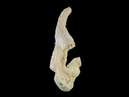 Kidney mucosa of dog plastinated specimen