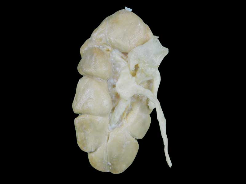 kidney of cow specimen plastination