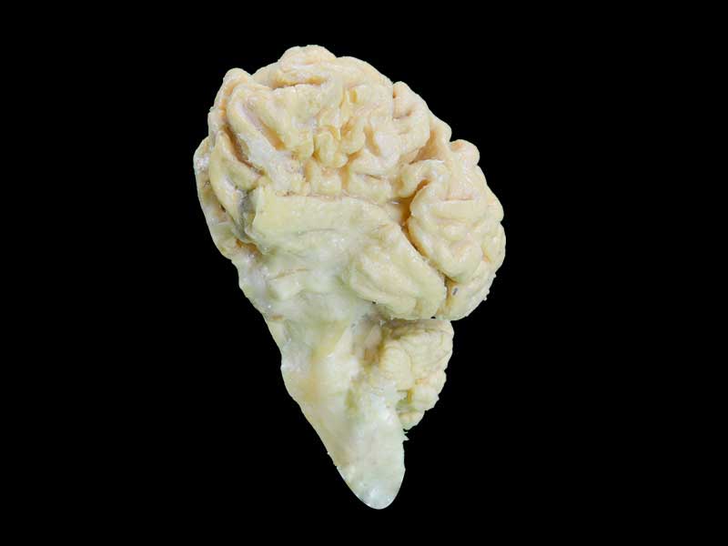 medical cattle  brain hemisphere specimen