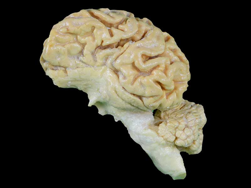 Pig brain hemisphere