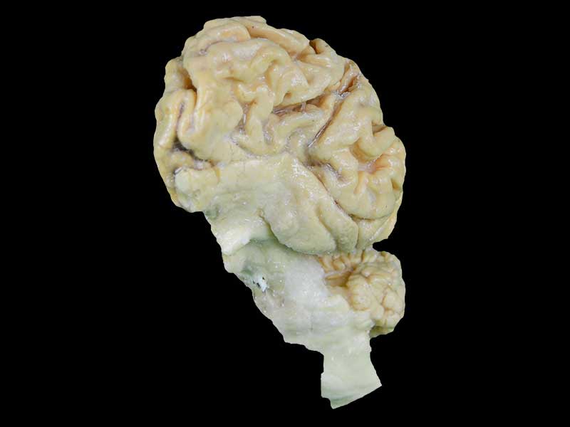 The anatomy of pig brain hemisphere