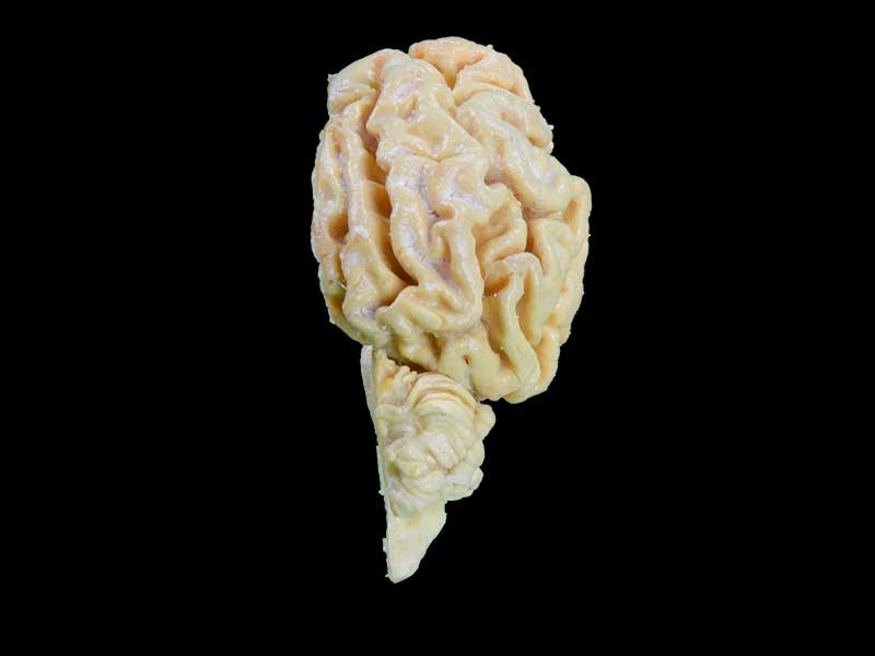 The brain hemisphere of dog plastinated specimen