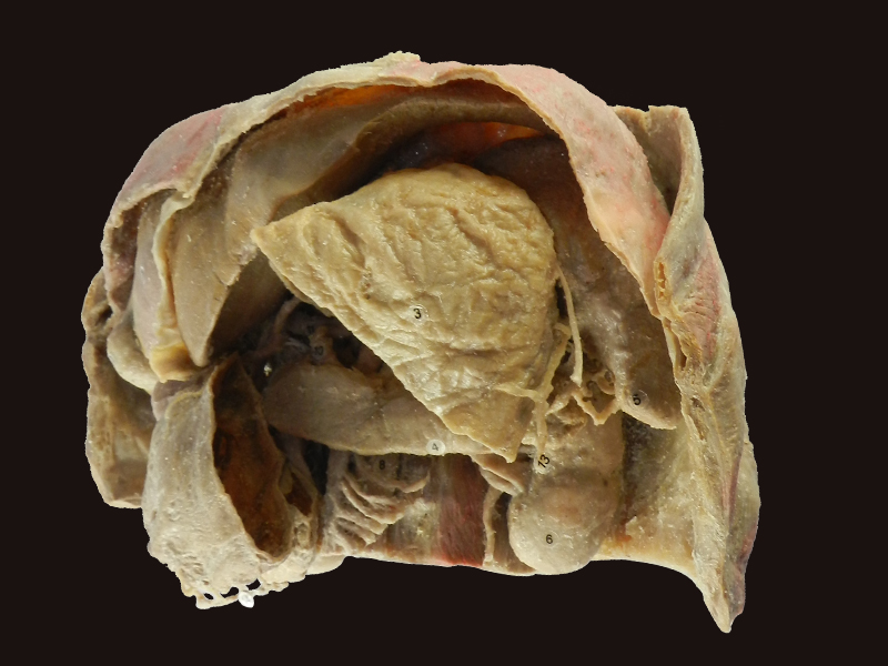 Abdominal viscera and caeliac trunk plastination