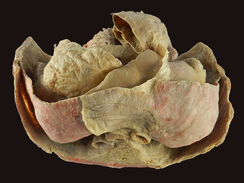 Abdominal viscera and caeliac trunk specimen