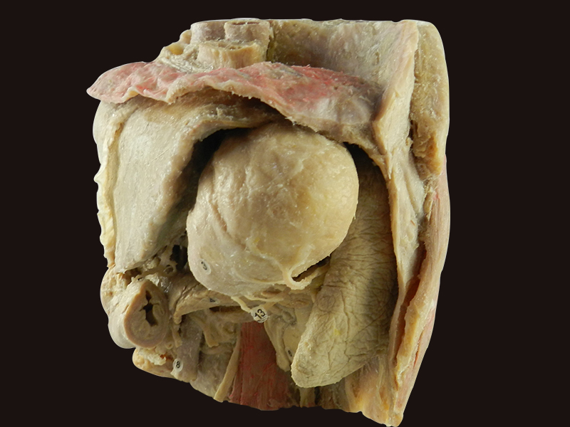 Abdominal viscera and caeliac trunk teaching specimen