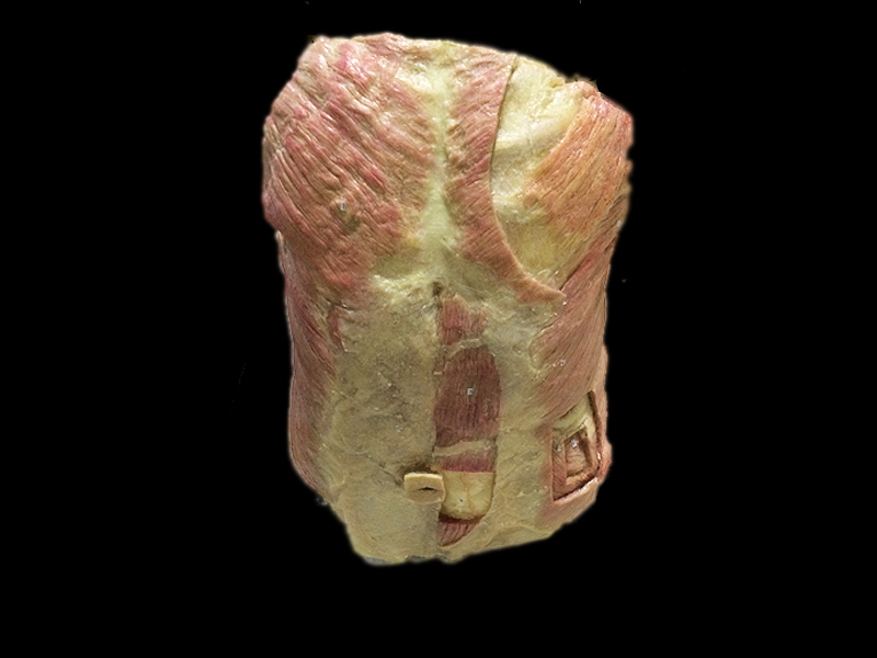 Anterior abdominal wall plastinated specimens,plastination, medical