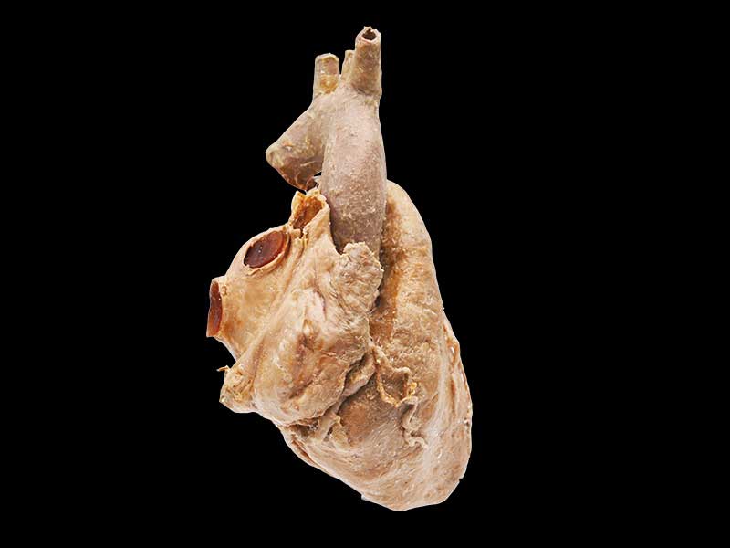 Cardiovascular human anatomy specimen