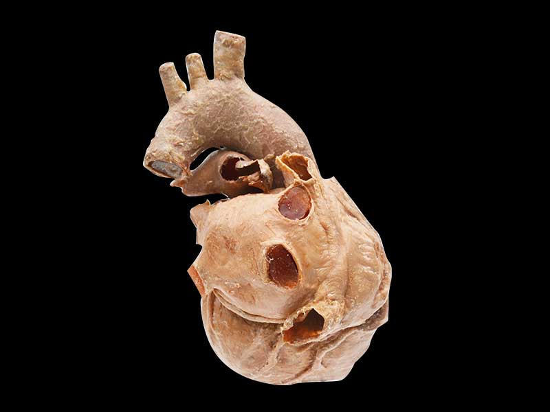 Cardiovascular human specimen
