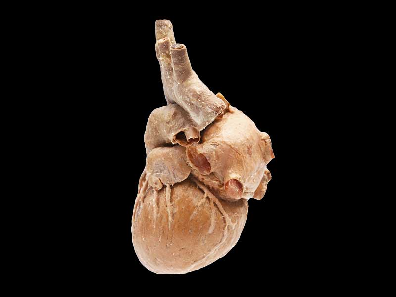 Cardiovascular plastianted specimen