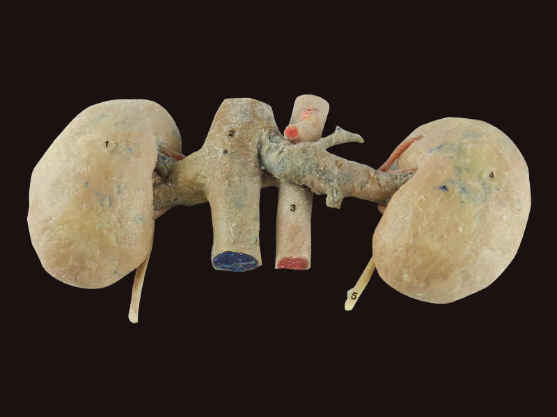 double kidney specimen for sale