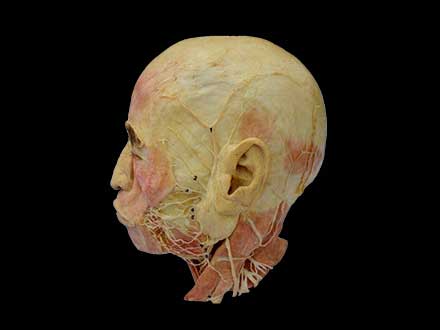Facial nerve plastinated specimen