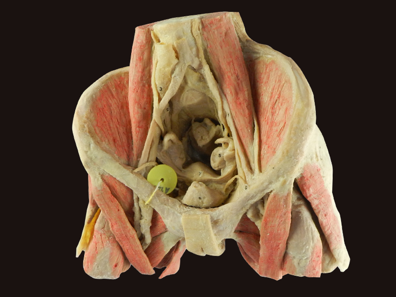 Female pelvic organs human plastination