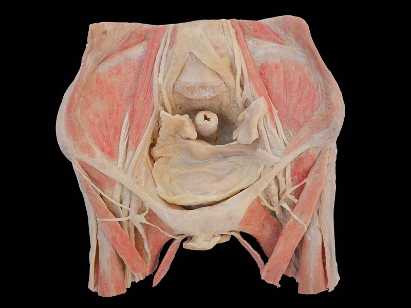Female pelvic organs human plastination