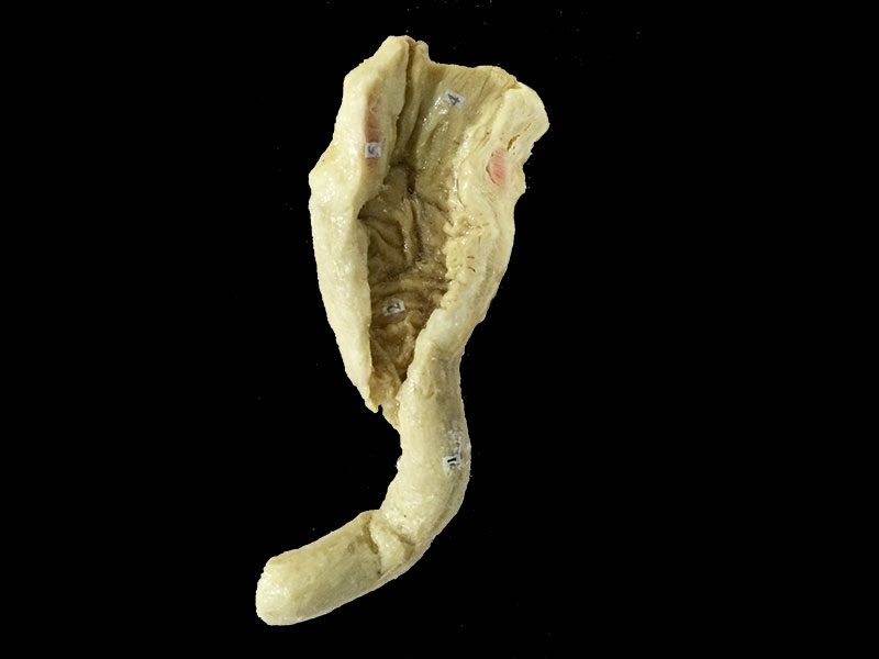interior view of rectum