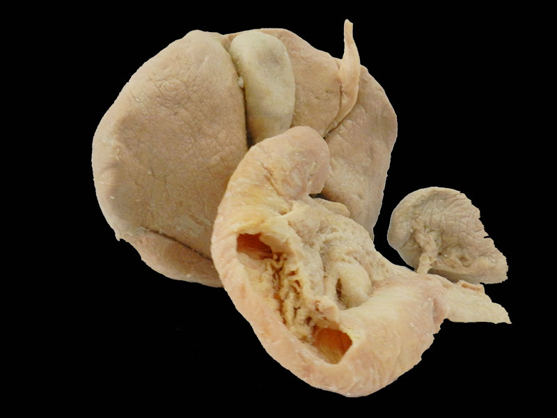 Liver pancreas duodenum spleen plastinated specimen