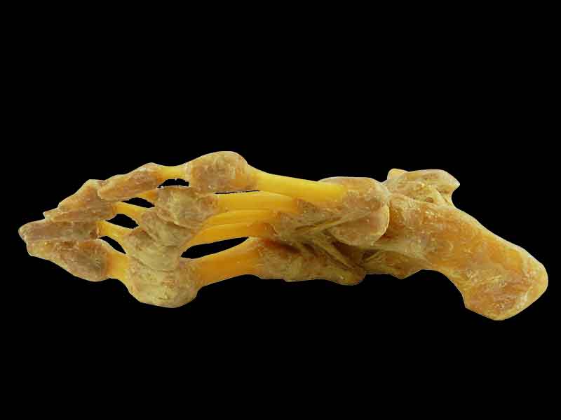 foot joint medical specimen