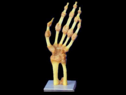 Joint of hand plastinated specimens ( body plastination)