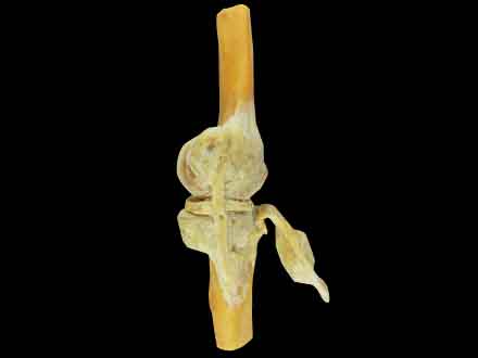Knee Joint (sagittal section)