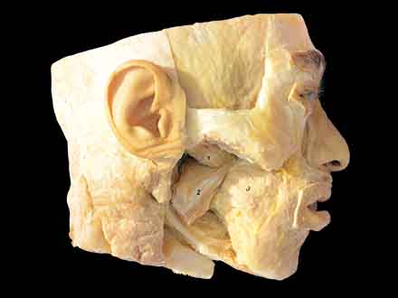 medial pterygoid and lateral pterygoid