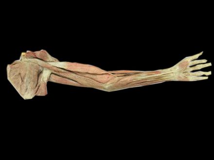 Superficial muscles of upper limb plastinated specimens(preserved specimens )