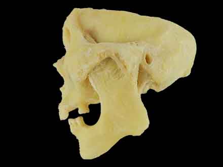 temporal mandibular joint plastinated specimen
