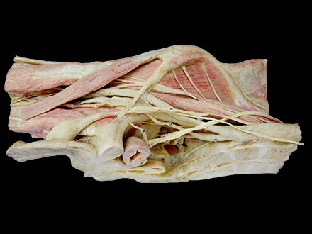 longitudinal section of female pelvis plastinated specimen
