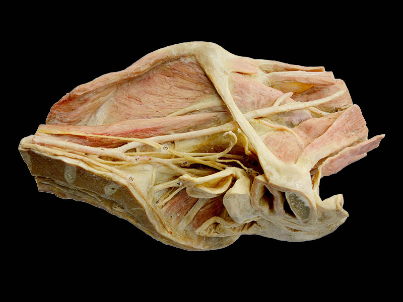 longitudinal section of female pelvis plastination
