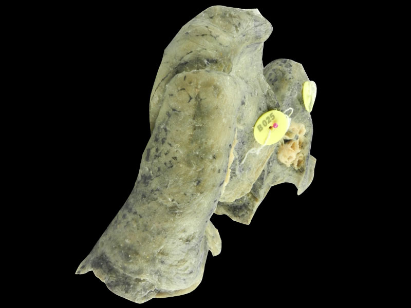 Root of the lung plastinated specimen