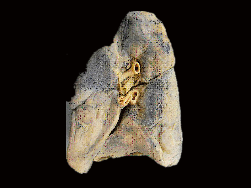 Root of the lung plastinated specimens ,lung plastinated specimens