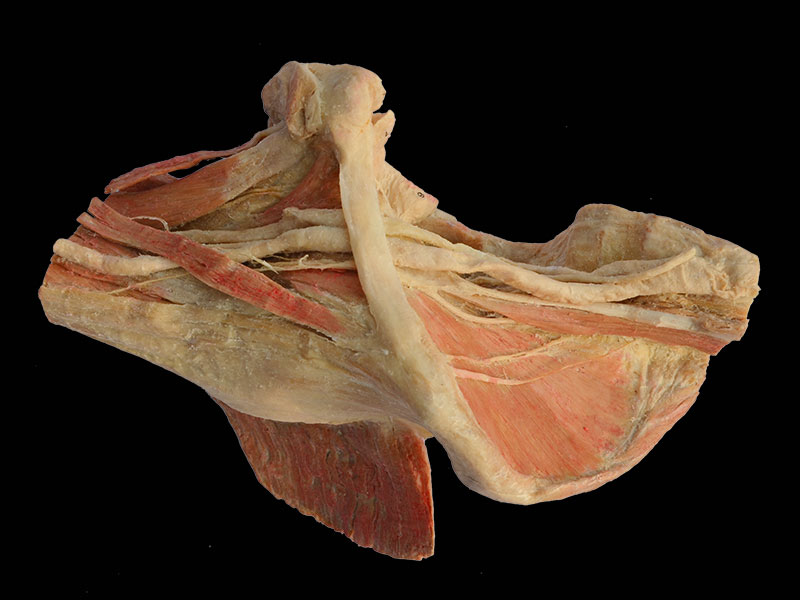 Sagittal section of Female pelvis human body plastination