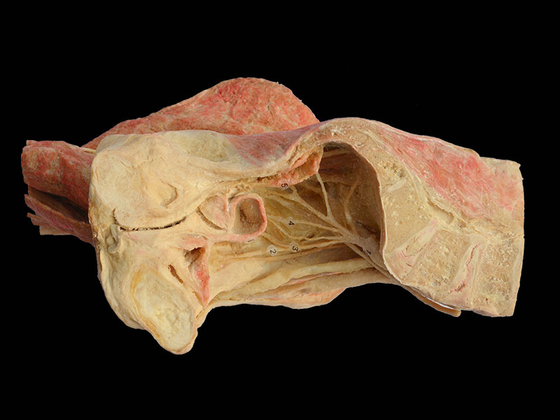 Sagittal section of Female pelvis human plastination
