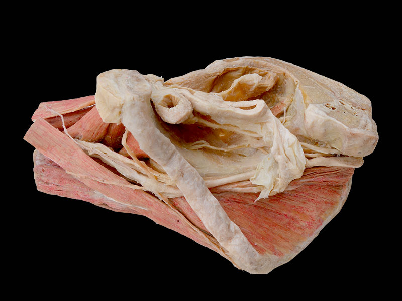 Sagittal section of Female pelvis plastination