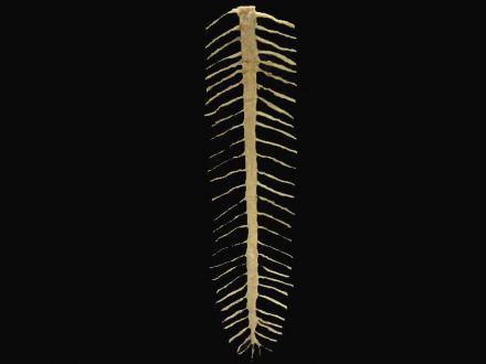 spinal cord plastinated specimens