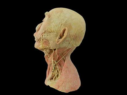 Superficial vascular nerve of head and neck plastination