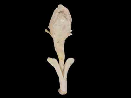 corpus cavernosum penis anatomic specimen