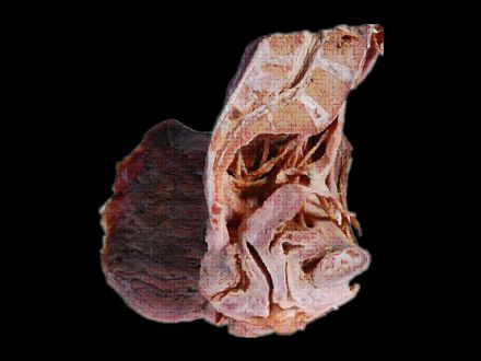 Median saggital section of female pelvis plastinated specimens