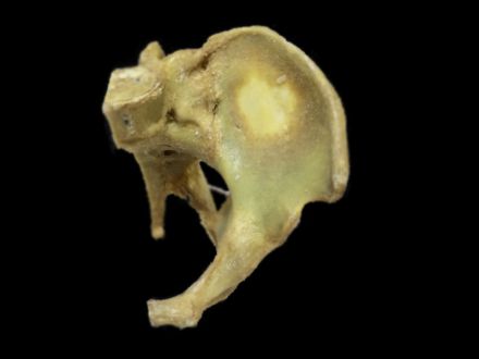 Sagittal section of a female pelvis plastinated specimens