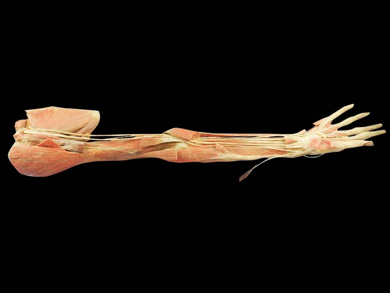Deep arteries  of upper limb plastination