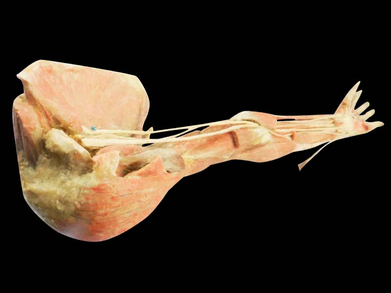 Deep arteries  of upper limb specimen