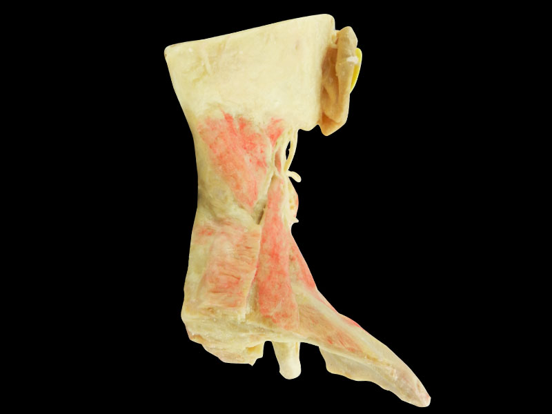 External carotid artery and its branches plastinated specimen