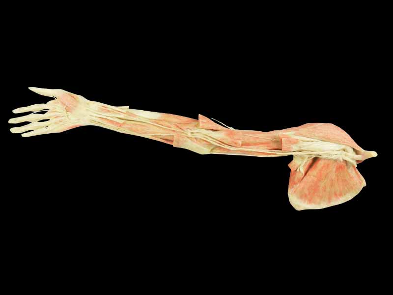 Upper limb artery plastination specimen