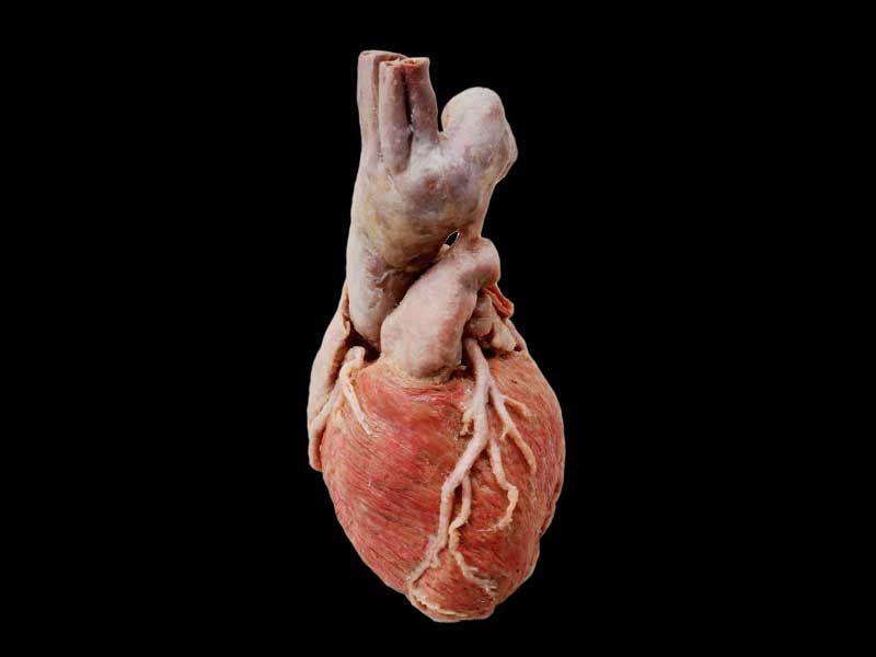 Whole heart plastinated human specimen