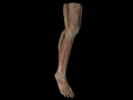 Superficial Muscles of Lower Leg Plastination